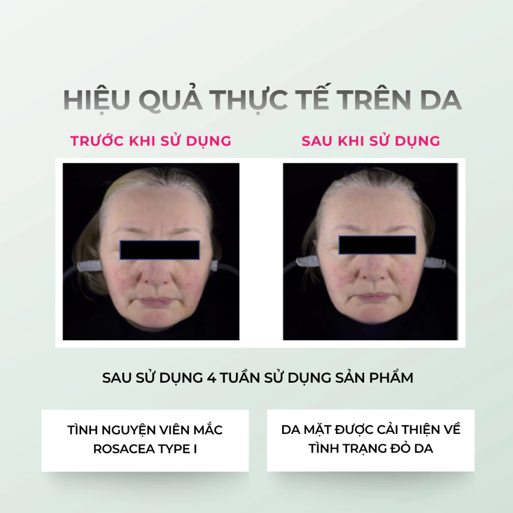Kem Dưỡng Da Ban Đêm Sebamed Anti-Redness Regenerating Intensive Care 50ml - Ảnh 7