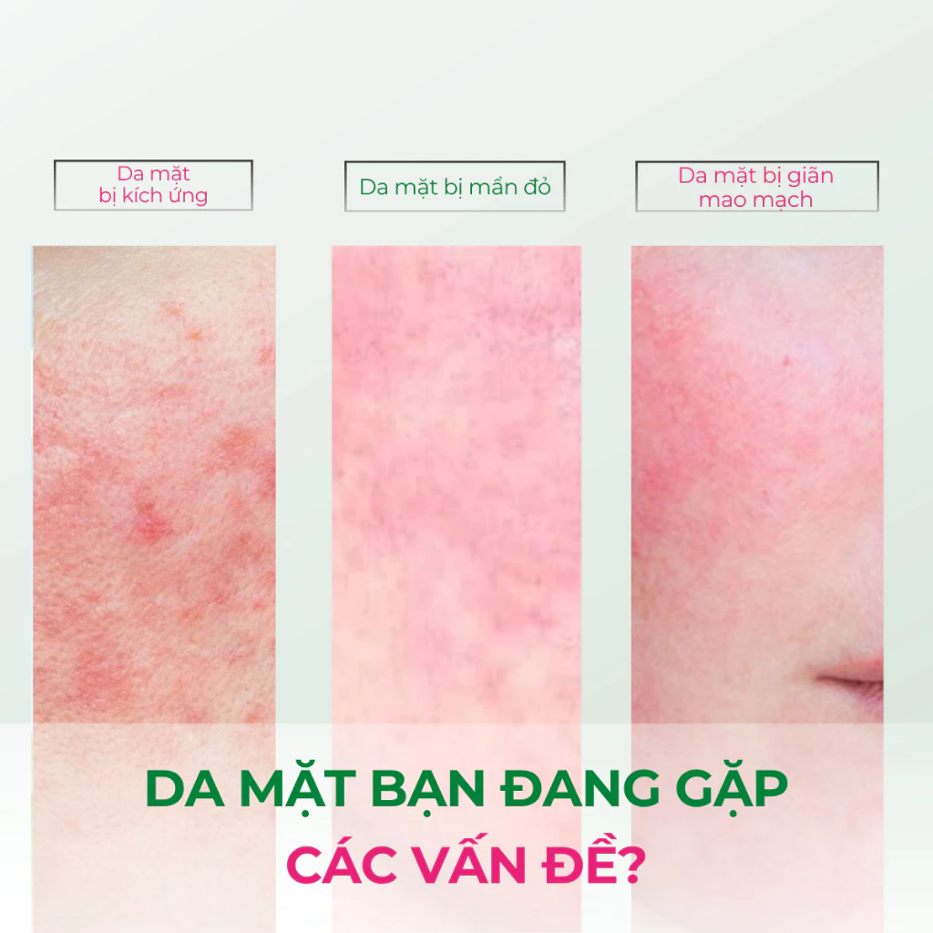 Kem Dưỡng Da Ban Đêm Sebamed Anti-Redness Regenerating Intensive Care 50ml - Ảnh 8