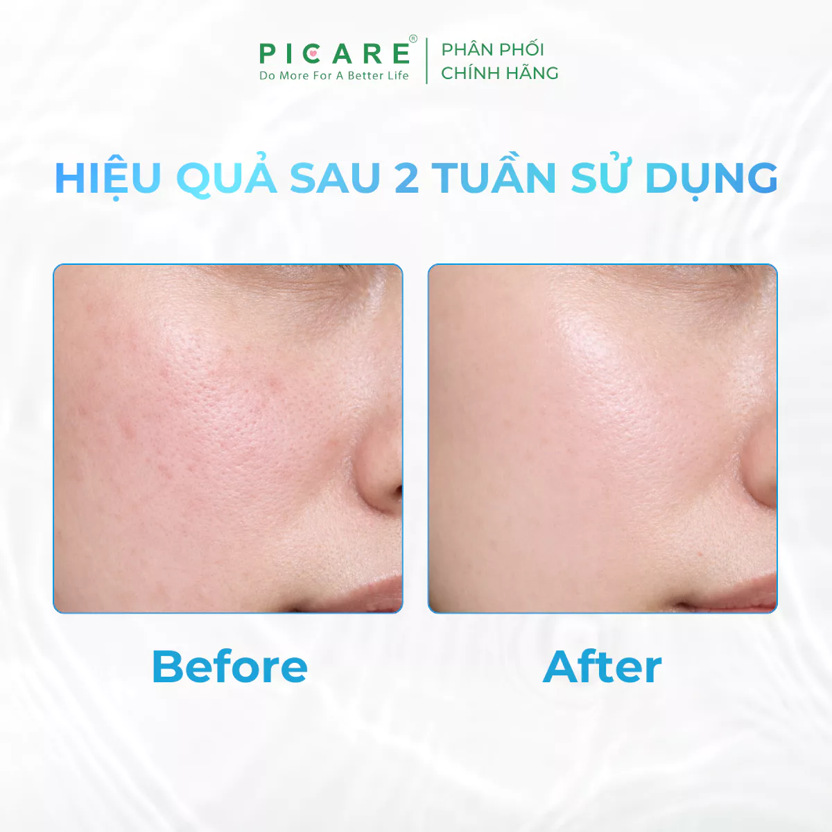 Tinh chất dưỡng sáng da cấp ẩm hỗ trợ phục hồi Juve'Heal Hydro Synergy Intensive Serum 50ml - Ảnh 5