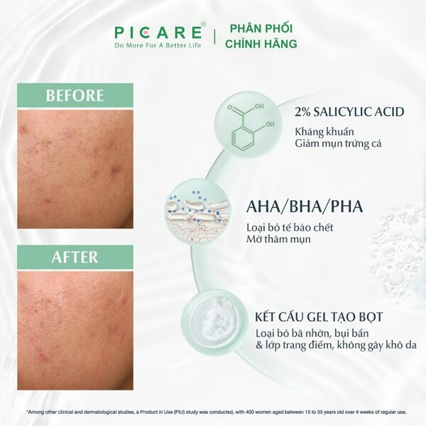 Gel rửa mặt cho da mụn Eucerin 3X Treatment Gel To Foam Cleanser 150G - Ảnh 6