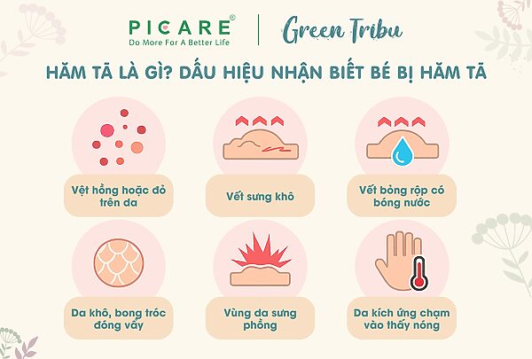 Bé bị hăm tã phải làm sao? Nguyên nhân và cách phòng ngừa?