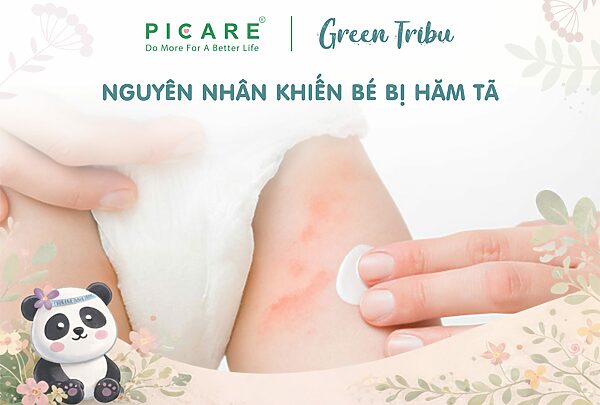 Bé bị hăm tã phải làm sao? Nguyên nhân và cách phòng ngừa?