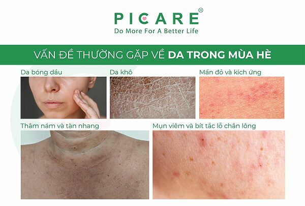 Picare Vietnam_Bí quyết chăm sóc da mùa hè